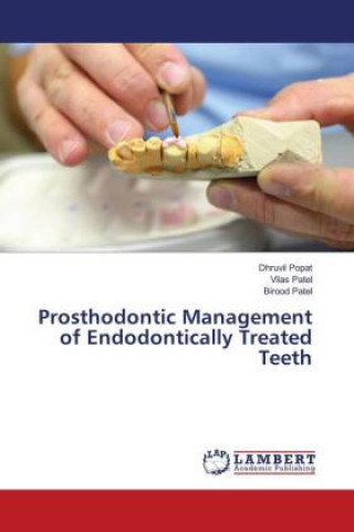Kniha Prosthodontic Management of Endodontically Treated Teeth Vilas Patel