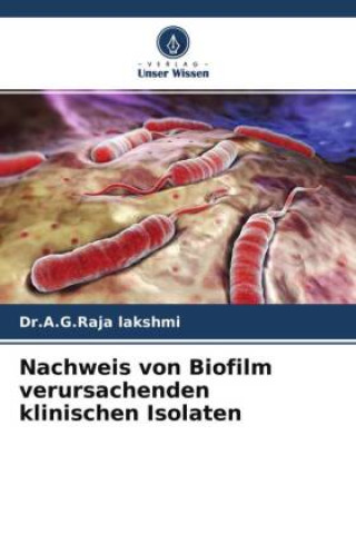 Livre Nachweis von Biofilm verursachenden klinischen Isolaten 