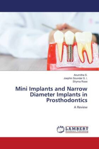 Könyv Mini Implants and Narrow Diameter Implants in Prosthodontics Joephin Soundar S. I.