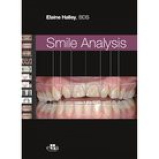Книга Smile Analysis HALLEY