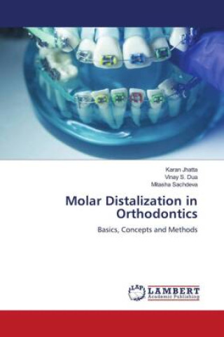 Livro Molar Distalization in Orthodontics Vinay S. Dua