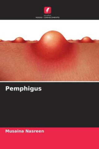 Knjiga Pemphigus Musaina Nasreen