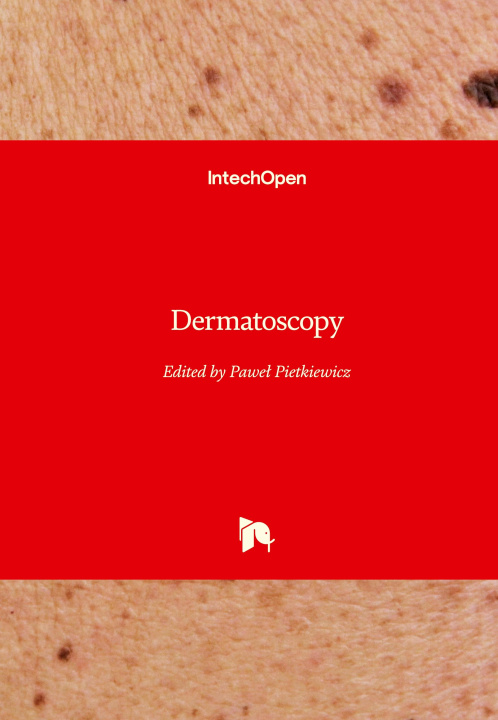 Könyv Dermatoscopy 
