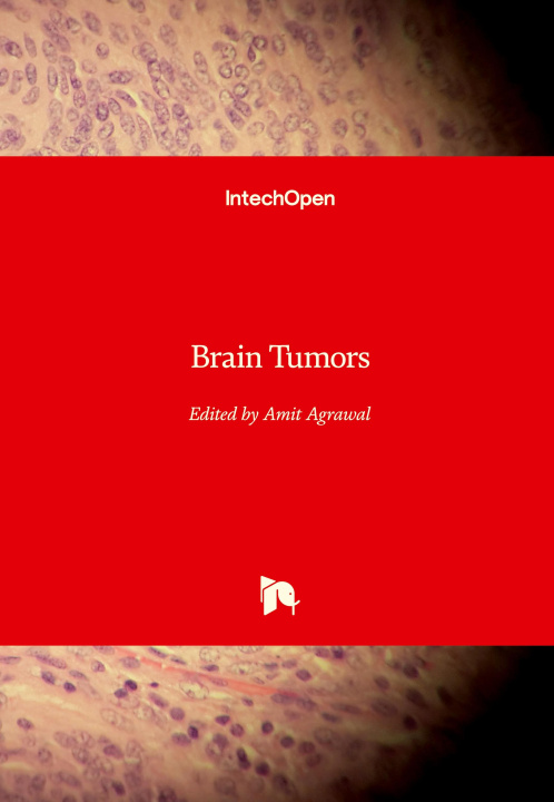 Knjiga Brain Tumors Amit Agrawal