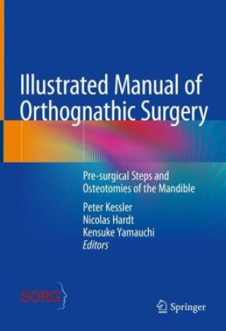 Könyv Illustrated Manual of Orthognathic Surgery Peter Kessler