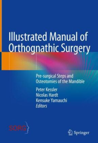 Kniha Illustrated Manual of Orthognathic Surgery Peter Kessler