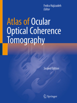 Kniha Atlas of Ocular Optical Coherence Tomography Fedra Hajizadeh