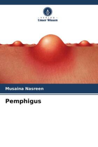 Book Pemphigus Musaina Nasreen