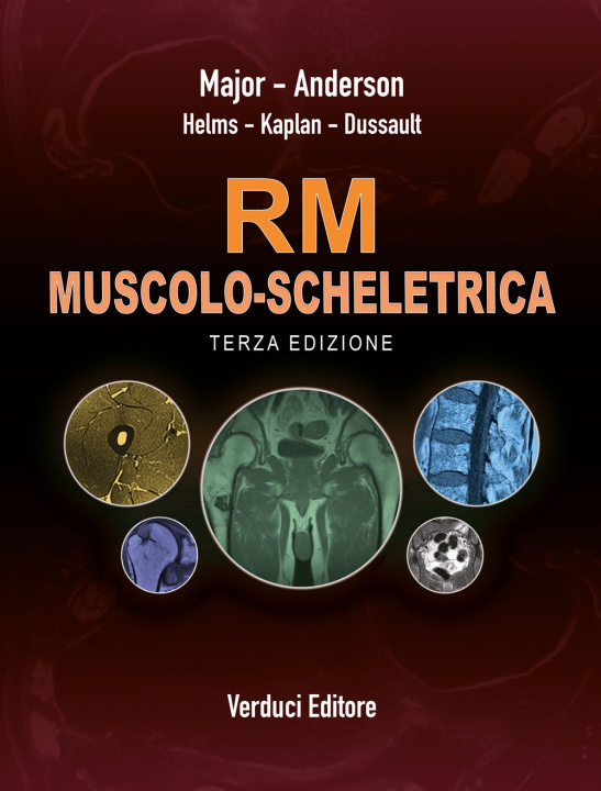 Kniha RM dell'apparato muscolo-scheletrico Thomas H. Berquist
