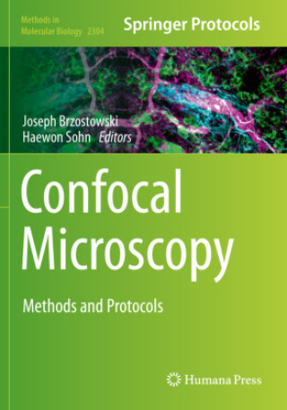 Carte Confocal Microscopy Joseph Brzostowski