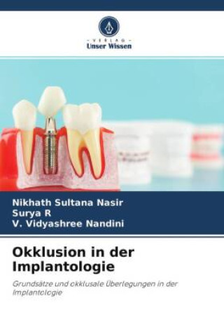 Kniha Okklusion in der Implantologie Surya R