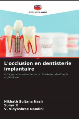 Kniha L'occlusion en dentisterie implantaire Surya R