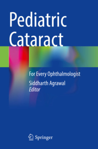 Knjiga Pediatric Cataract Siddharth Agrawal