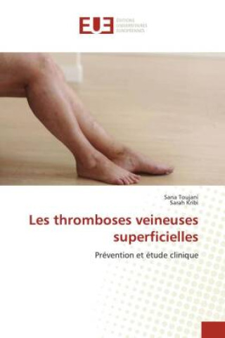 Boek Les thromboses veineuses superficielles Sarah Kribi