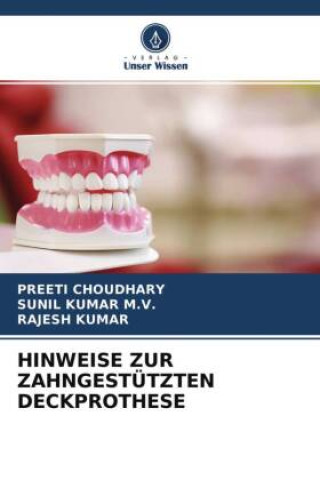 Könyv HINWEISE ZUR ZAHNGESTÜTZTEN DECKPROTHESE Sunil Kumar M. V.