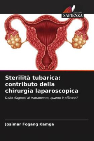 Boek Sterilit? tubarica: contributo della chirurgia laparoscopica Josimar Fogang Kamga