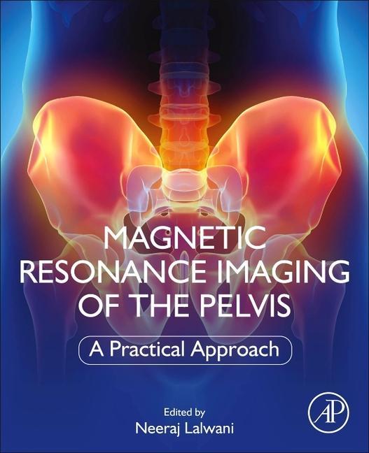 Książka Magnetic Resonance Imaging of The Pelvis Neeraj Lalwani