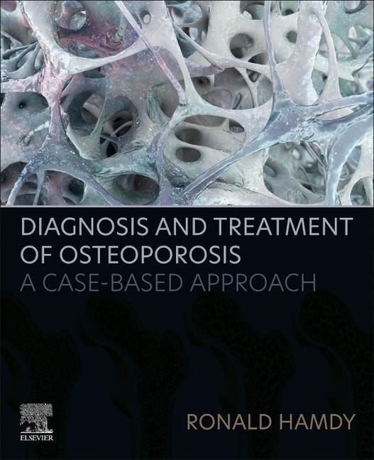 Kniha Diagnosis and Treatment of Osteoporosis Ronald Hamdy