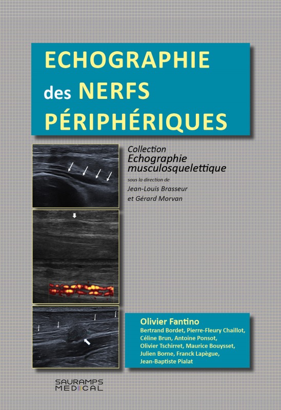 Carte ECHOGRAPHIE DES NERFS PERIPHERQUES FANTIMO OLIVIER & COLL