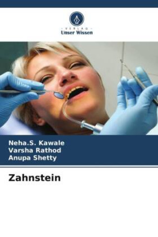 Kniha Zahnstein Varsha Rathod