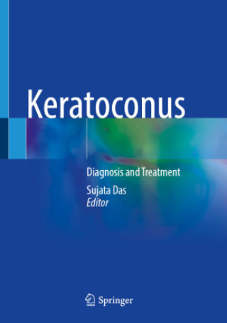 Könyv Keratoconus Sujata Das