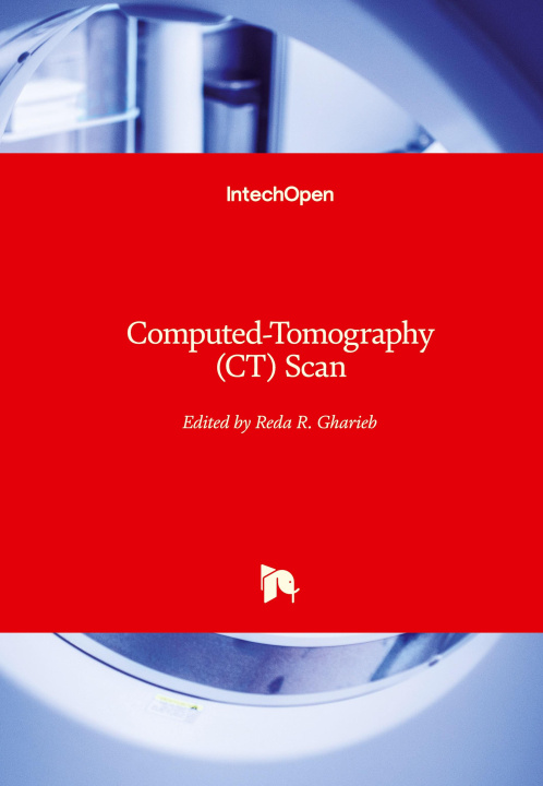 Knjiga Computed-Tomography (CT) Scan Reda R. Gharieb