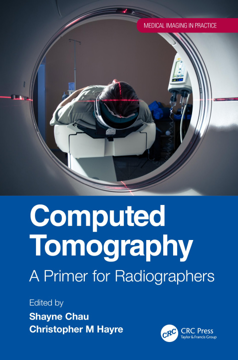 Carte Computed Tomography 