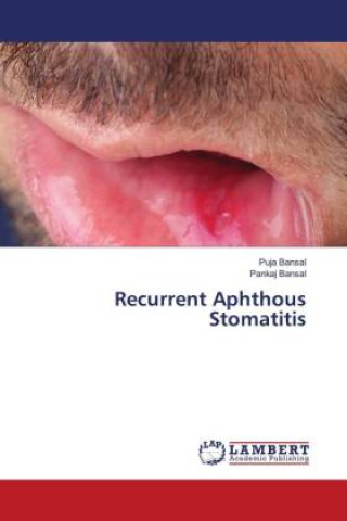 Buch Recurrent Aphthous Stomatitis Pankaj Bansal