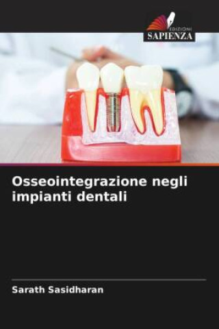 Knjiga Osseointegrazione negli impianti dentali Sarath Sasidharan