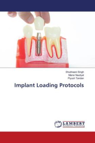 Knjiga Implant Loading Protocols Mansi Nautiyal
