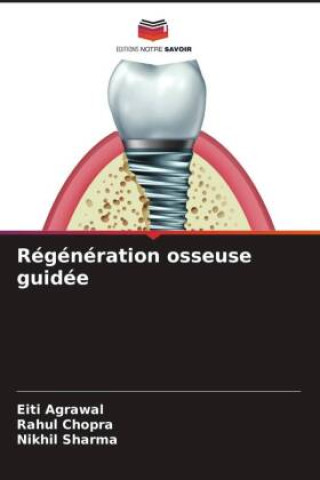 Boek Régénération osseuse guidée Rahul Chopra