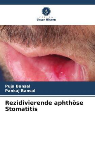Buch Rezidivierende aphthöse Stomatitis Pankaj Bansal