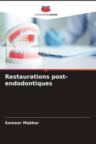 Knjiga Restaurations post-endodontiques Uzma Mushtaq