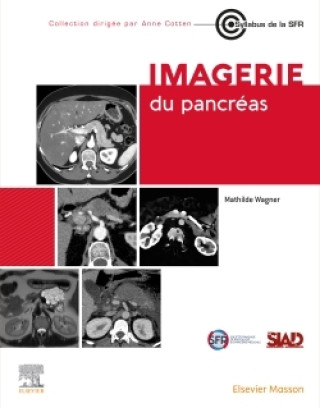 Книга Imagerie du pancréas Docteur Mathilde Wagner