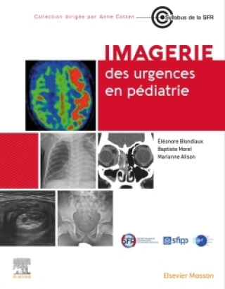Kniha Imagerie des urgences en pédiatrie Docteur Eléonore Blondiaux