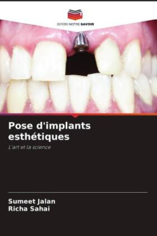 Knjiga Pose d'implants esthétiques Richa Sahai