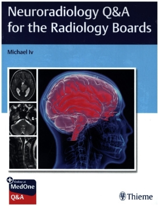 Kniha Neuroradiology Q&A for the Radiology Boards 