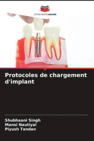 Knjiga Protocoles de chargement d'implant Mansi Nautiyal