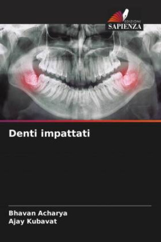 Книга Denti impattati Ajay Kubavat