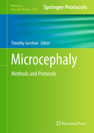 Knjiga Microcephaly Timothy Gershon