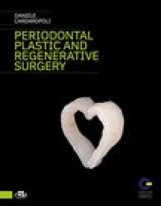 Kniha Periodontal Plastic and Regenerative Surgery L. Landi