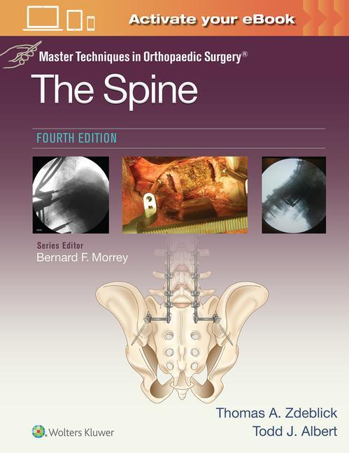 Kniha Master Techniques in Orthopaedic Surgery: The Spine Thomas A. Zdeblick