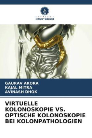 Buch VIRTUELLE KOLONOSKOPIE VS. OPTISCHE KOLONOSKOPIE BEI KOLONPATHOLOGIEN Kajal Mitra