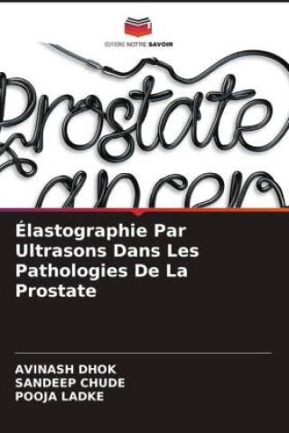 Kniha Élastographie Par Ultrasons Dans Les Pathologies De La Prostate Sandeep Chude