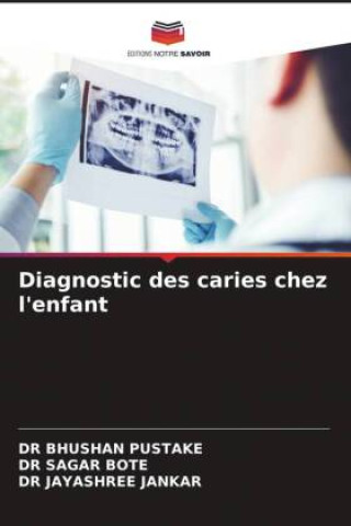 Knjiga Diagnostic des caries chez l'enfant Sagar Bote