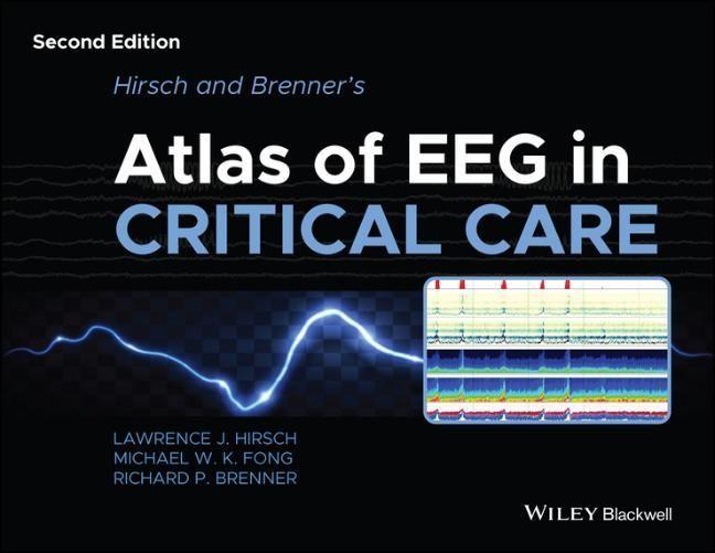 Könyv Hirsch and Brenner's Atlas of EEG in Critical Care , 2nd Edition 