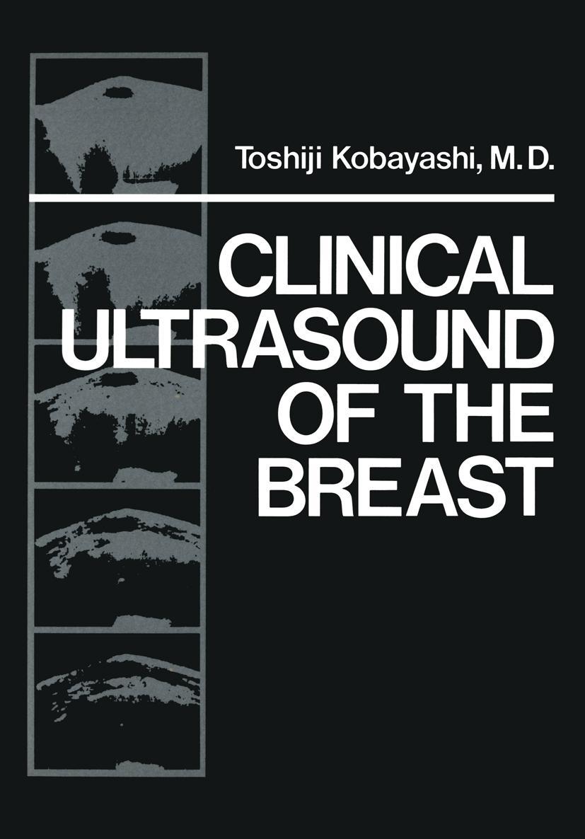 Könyv Clinical Ultrasound of the Breast 
