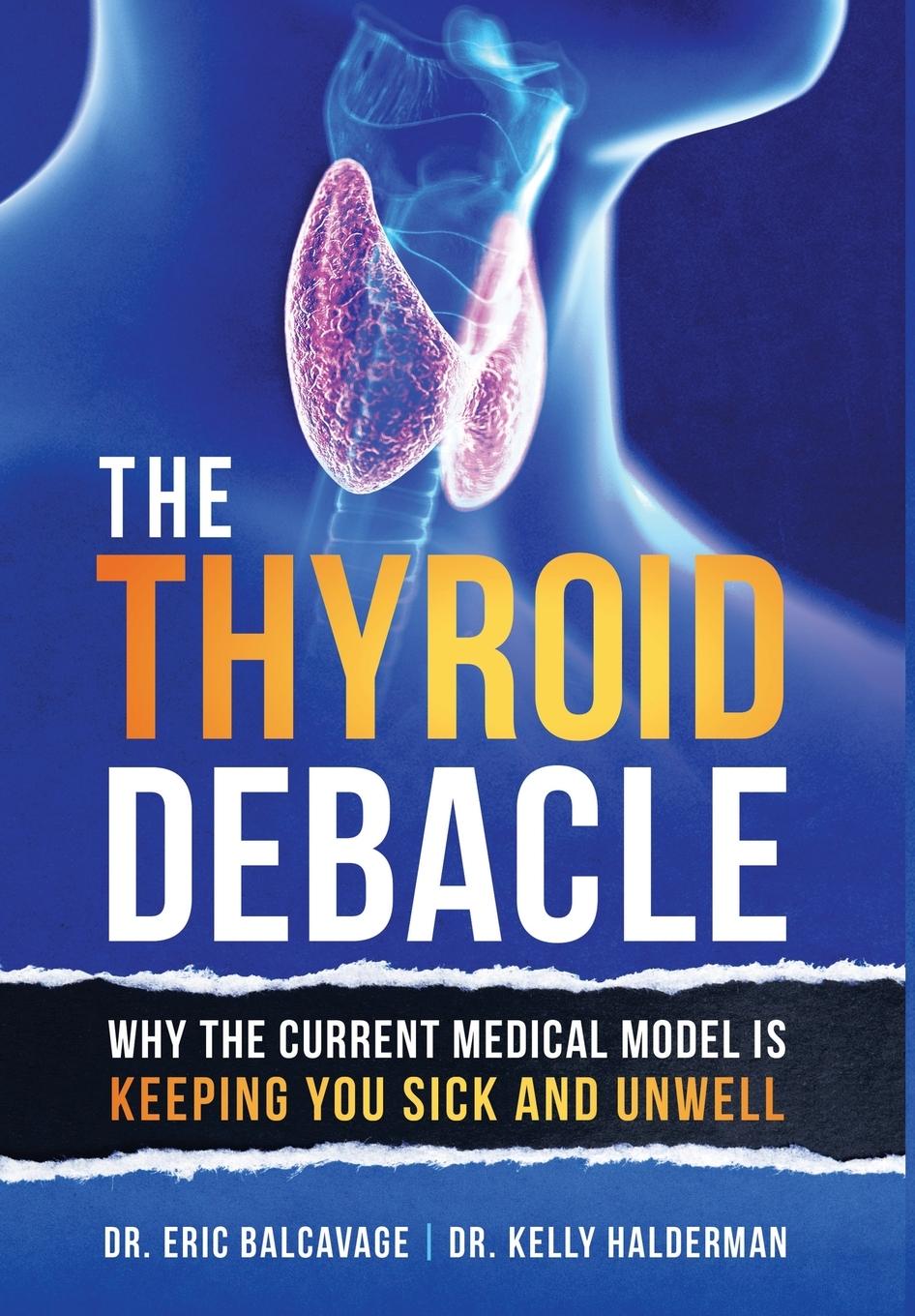 Kniha Thyroid Debacle Kelly Halderman