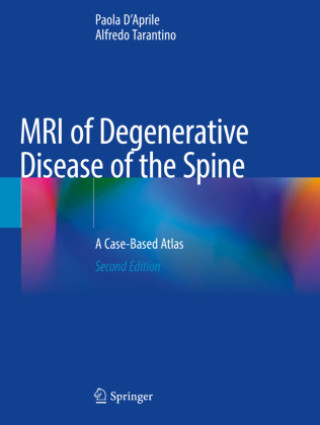 Kniha MRI of Degenerative Disease of the Spine Paola D'Aprile