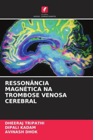 Kniha RESSONÂNCIA MAGNÉTICA NA TROMBOSE VENOSA CEREBRAL Dipali Kadam